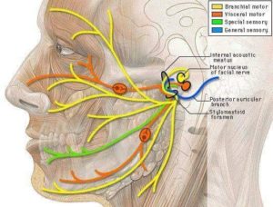 العصب السابع .. أعراض وعلاج شلل الوجه المؤقت
