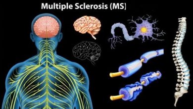 التصلب المتعدد .. «نوفارتس» تُطلق علاجًا جديدًا لمرضى (SPMS) في مصر (تفاصيل)